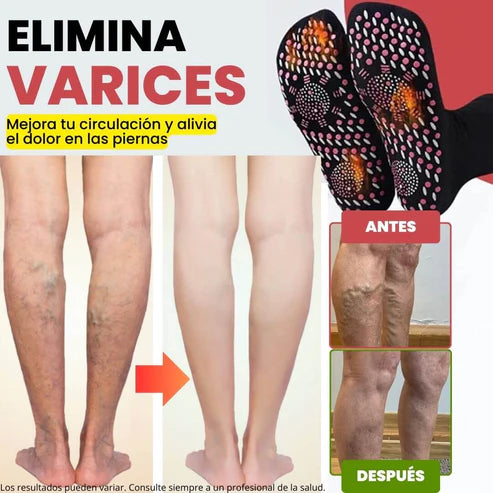 Calcetines de acupresión Anti-Varices